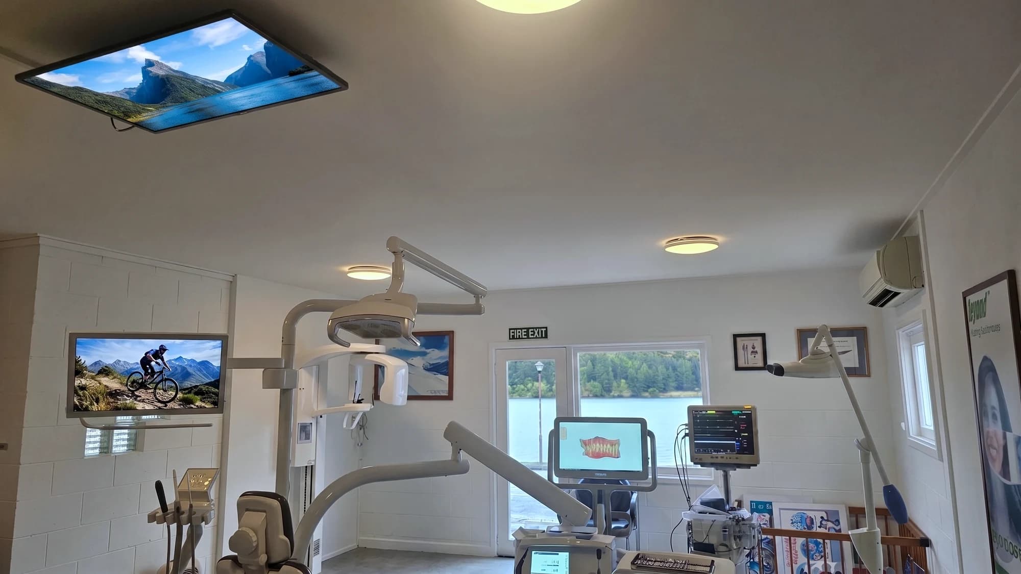 A TV on the ceiling at Lakeside Dental Practice, with Lake Wakatipu through the window